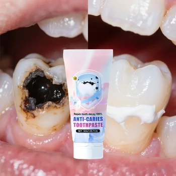 Ripara i denti, previene la carie dei denti e rimuove efficacemente la placca dentale 1