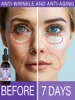 2025 Best Anti-Wrinkle Serum  - Firming Reduces Fine Lines & Deep Wrinkles - Top Rated Anti-Aging Treatment for Women & Men 1