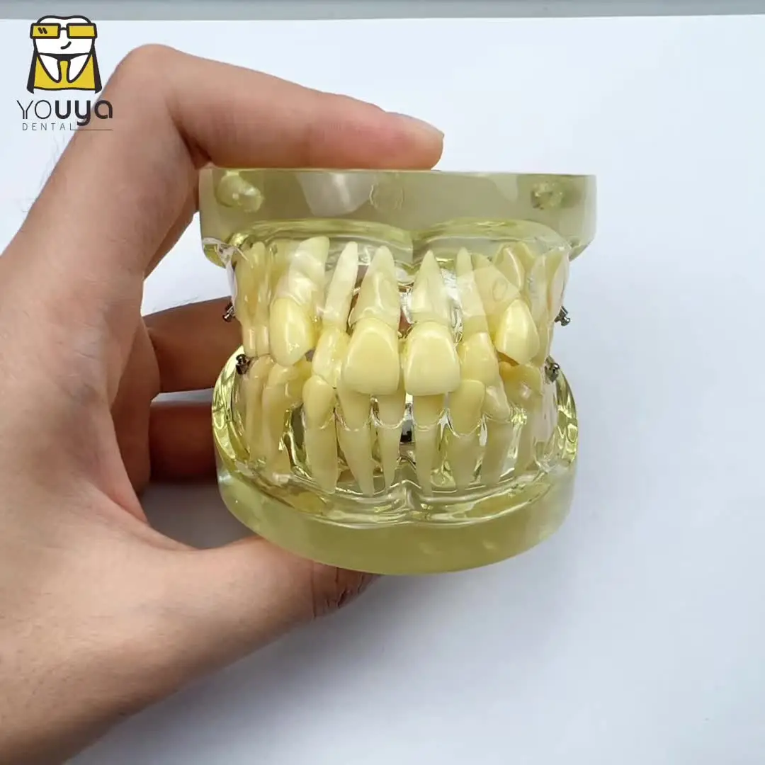 Modello Con Vallo Di Occlusione In Resina | GF Dental - Foto 8