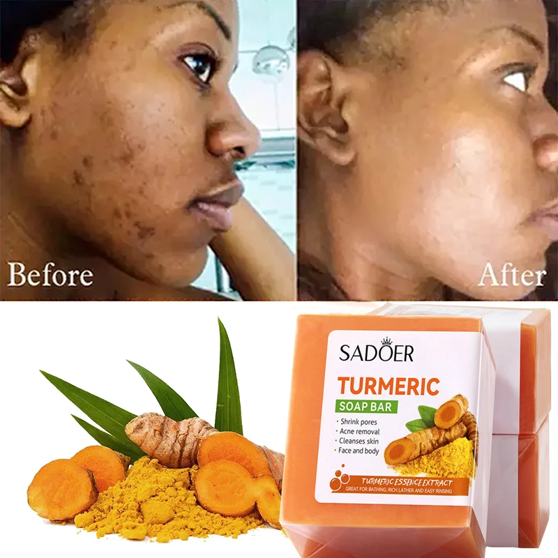 Kojic Acid Dark удаление пятен мыло для очистки лица, контроль жирности, равномерные тонизированные продукты для кожи, натуральная куркума, мыло, Новинка