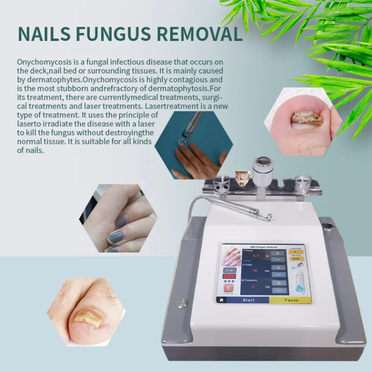 

Long Lasting Results 980 Nm Vascular Removing Nails Fungus Removal Pain Physiotherapy For Salon