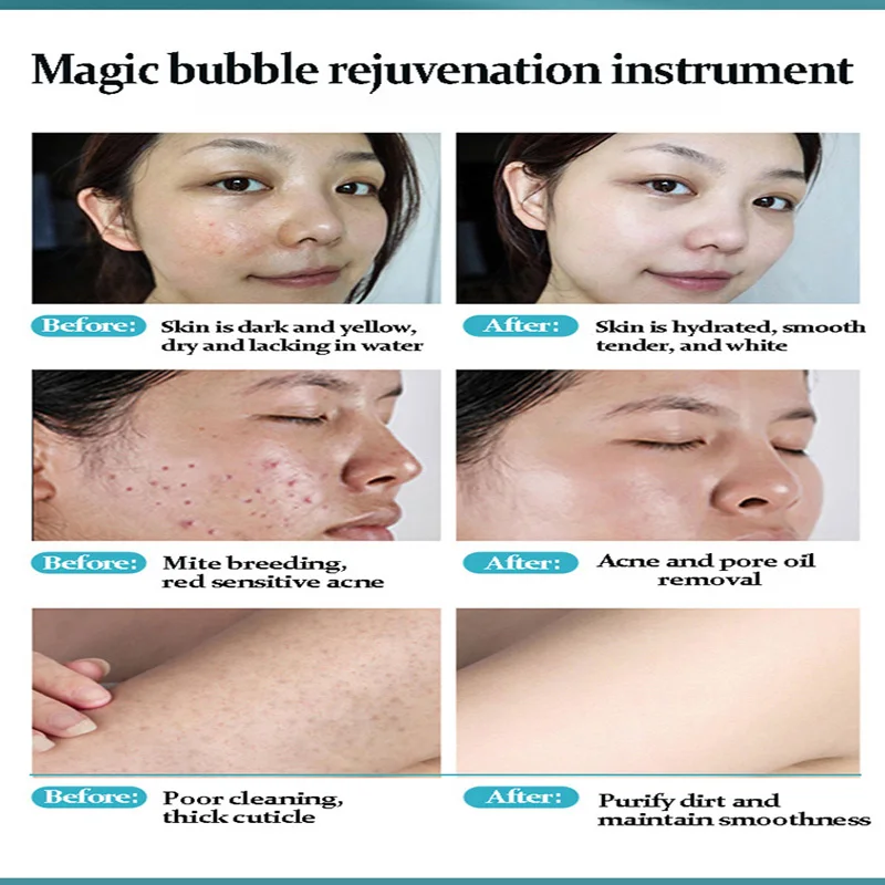New Magic Oxygen Bubble Machine Special Liquid for Whole Body Whitening Rejuvenating Mite Removing Skin Deep Cleaning Solution 6