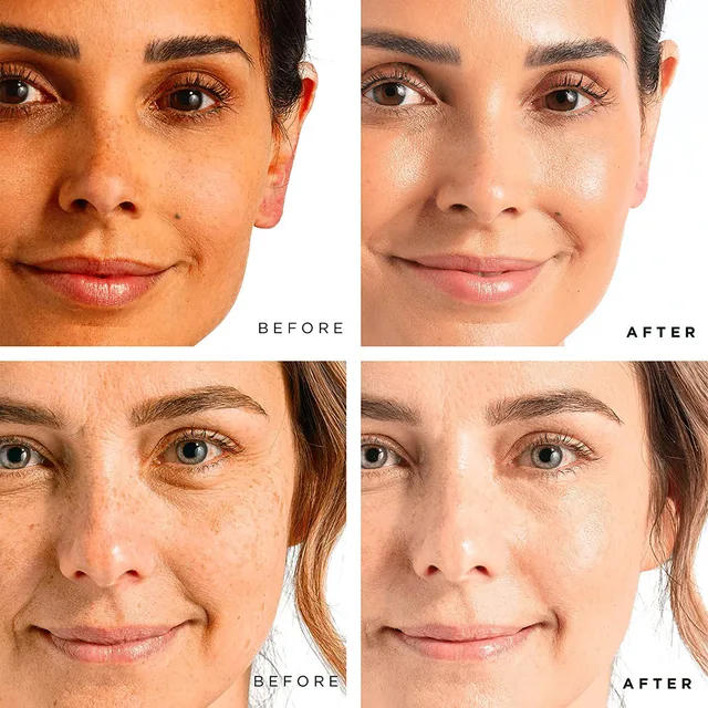 Ailke-Vitaminok C&E Előrehaladott 2% Retinoid Arc Szérum, Öregedésgátló Retinol Szérum A Bőr Ragyogására, Izzó, Hidratáló - Image 6