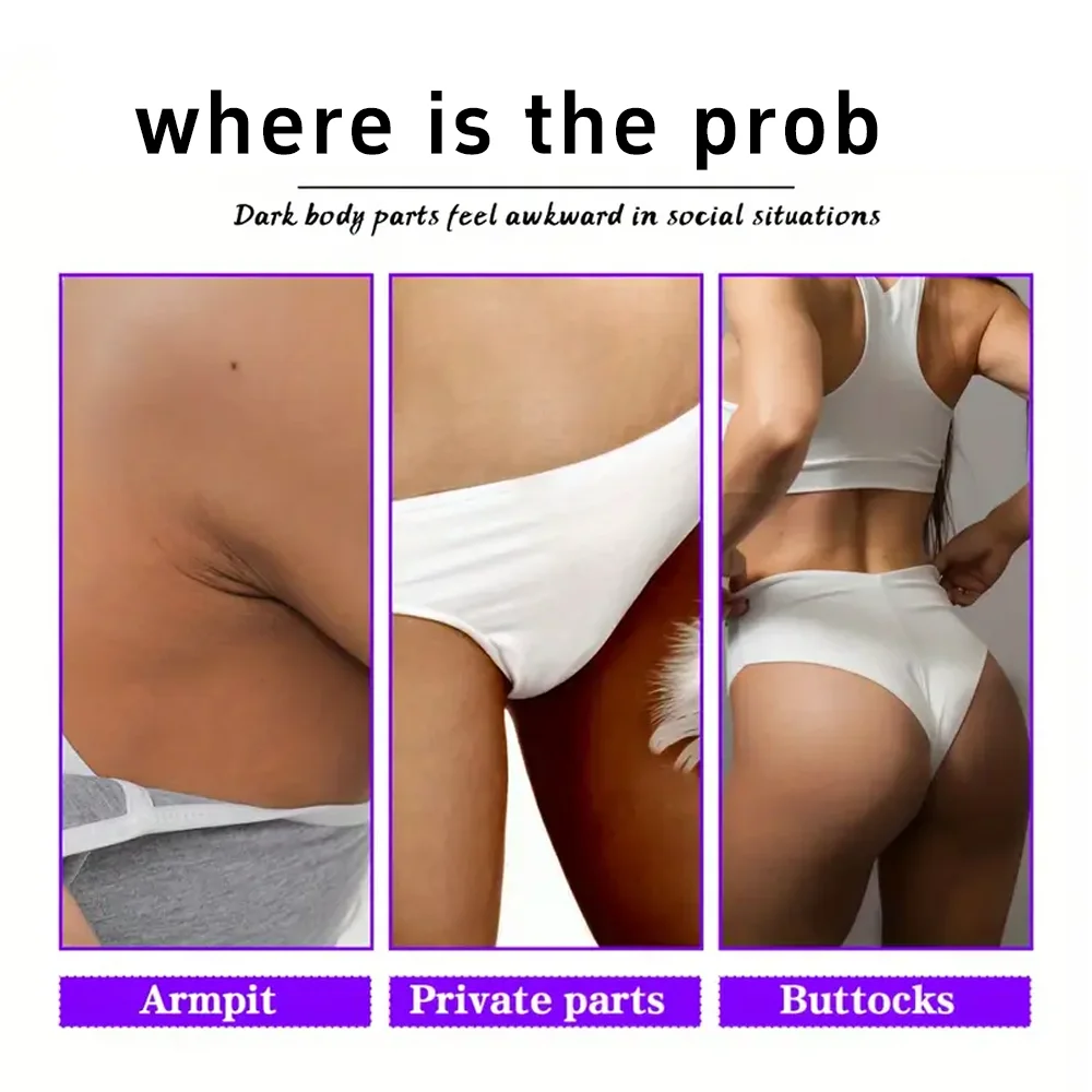 YUITIKUE whitening cream is suitable for dull skin, underarm bleaching, underarm brightening, and intimate area care for women.