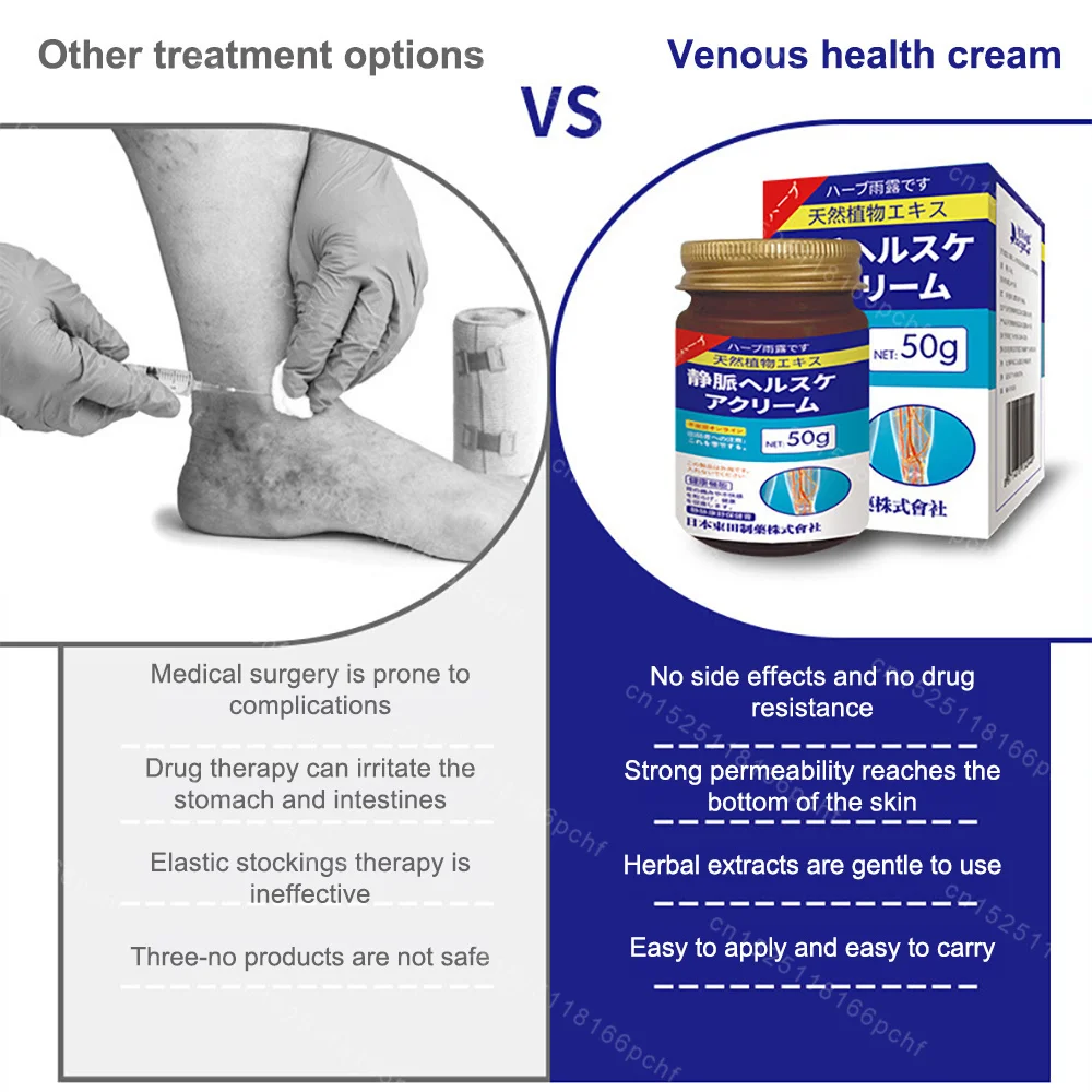 Varicose Vein Lampshade Therapy Effective Improved Blood Circulation Relief of Dilated Vasculitis In The Legs Phlebitis