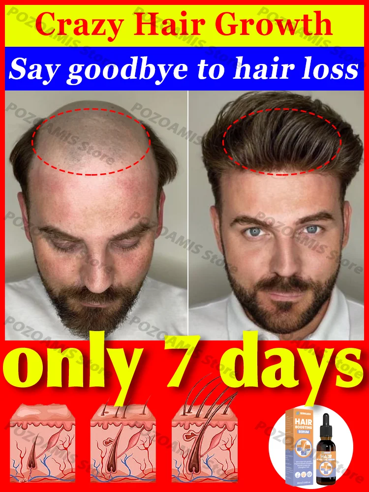 Essential Oil For Crazy Hair Growth, This Time Get Back All The Hair You Lost