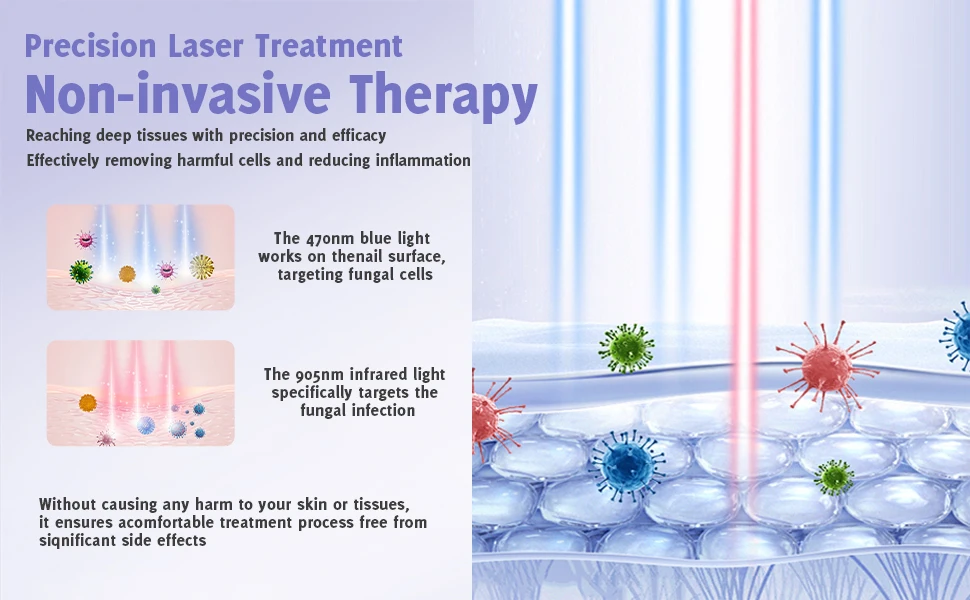 Nail Laser Led Light Device For Fungus And Discoloured Nails_voghion.com