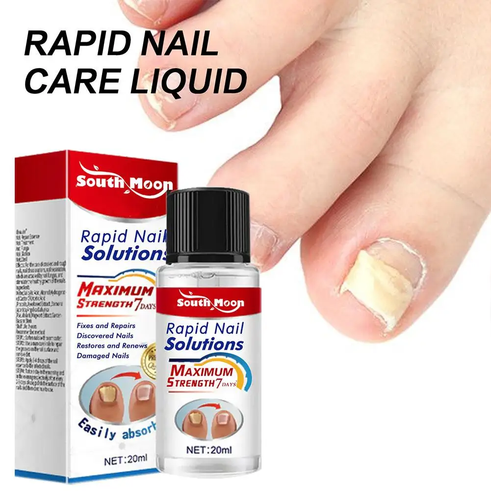 

Fungal Nail Treatment Oil 20ml Foot Repair Essence Re Nail Cream Toe Fungus Anti Nail Infection Gel Fungal Oil Care Removal Z5H4