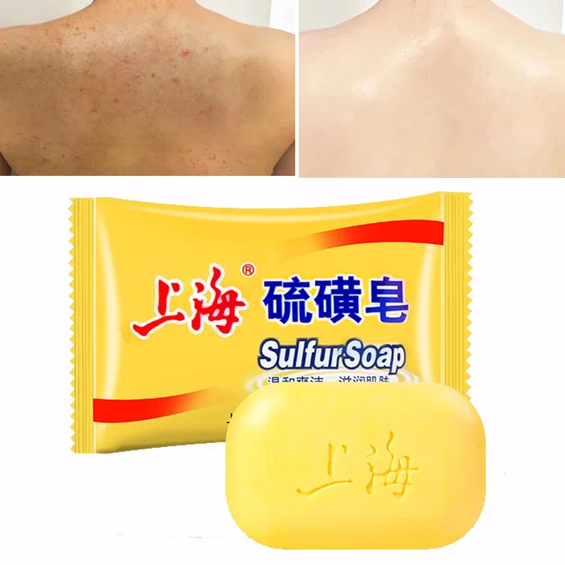 

Shanghai Sulfur Soap for Bath Oil-Control Acne Eczema Anti Fungus Facial Cheap Whitening Healthy Soaps Eczema