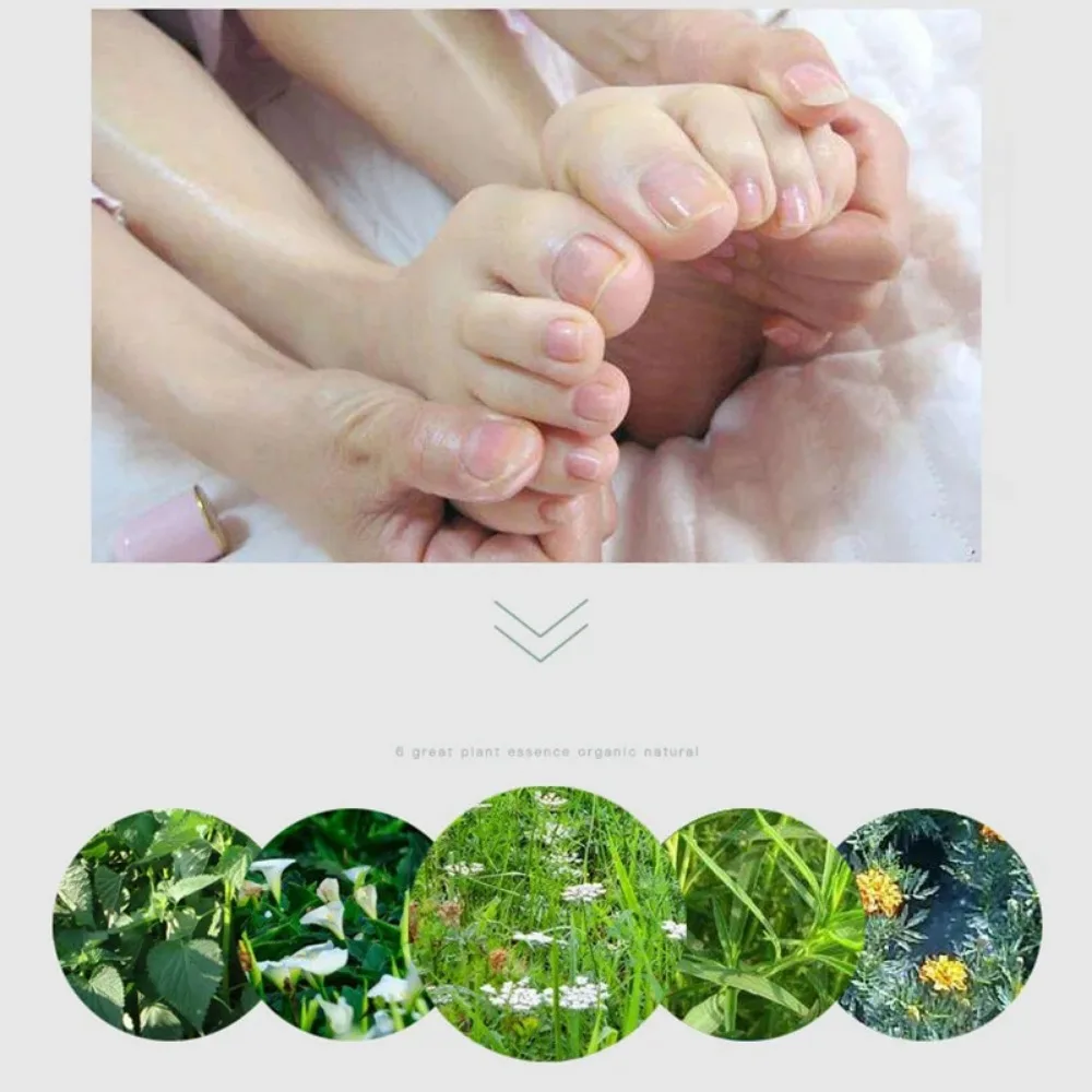 Nail Fungus Remover Foot Anti-Fungus Cream