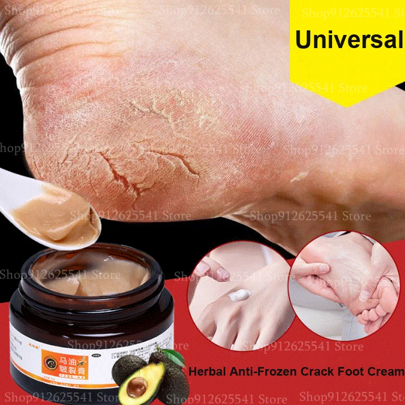 Horse Oil Anti-Frozen Crack Foot Cream Heel Hand Cream Chapped Cream Hydrating Exfoliating Remove Calluses Anti-drying 30g