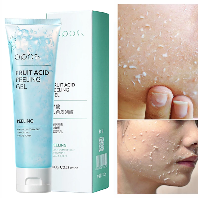 Fruit Acid Exfoliation Exfoliating Peeling Gel Facial Scrub Deep Clean Acne Blackhead Cleanser Whitening Oil Control Skin Care natural lava exfoliating pumice stone callus remover for feet exfoliation to remove dead skin for foot heel toes