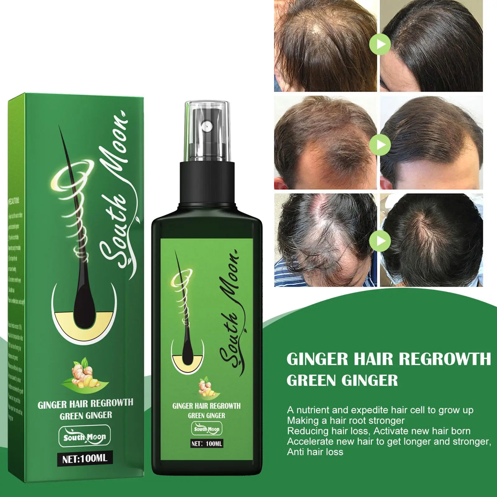 Ginger Hair Growth Spray Serum For Anti Hair Loss Essential Oil Products Fast Treatment Prevent Hair Loss Hair Growth Scalp Care