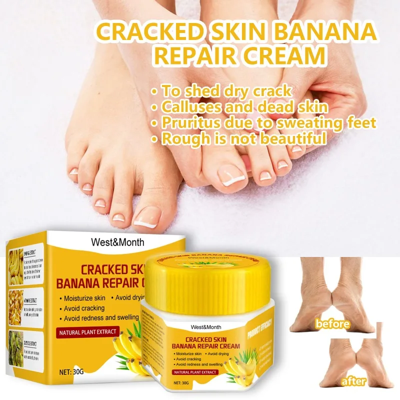

Anti Crack Foot Cream Heel Cracked Repair Cream Smooth Removal Dead Skin Callus Anti-Drying Moisturizing Hand Feet Skin Care 30g