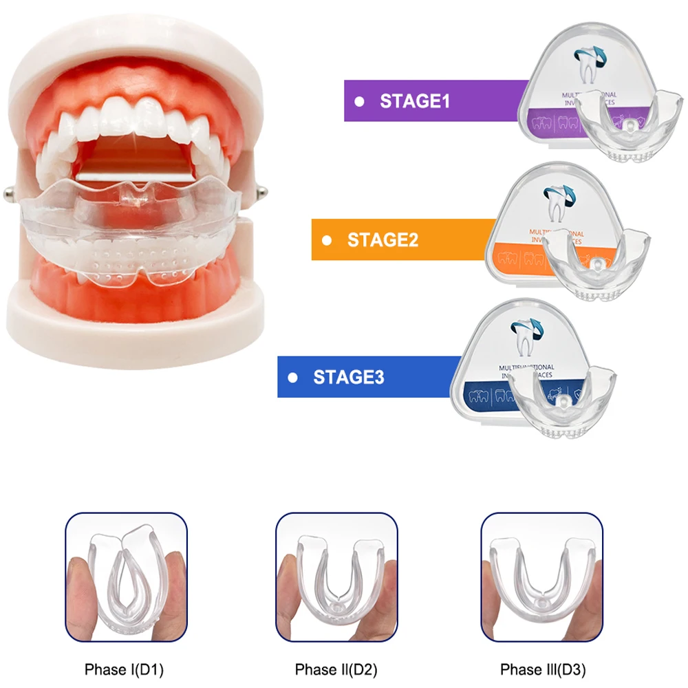 Teeth Alignment Trainer 3 Stages Orthodontic Braces Dental Braces Smile Teeth Alignment Trainer Instanted Silicone Teeth Retainer Transparent Corrector