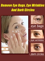 Remove bags Puffiness away work under eyes 2