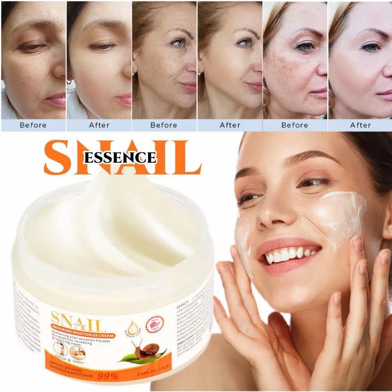 

Snail Essence Repair Cream for Face Deluxe Anti Aging Moisturizer Reduce Wrinkles,Fine Lines,Day and Night Collagen Skin Care