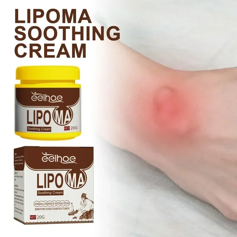 Soothing Cream Subcutaneous Lumps Remover cream lumps remover
