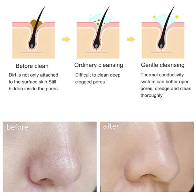 brosse nettoyante visage électrique de nettoyage du visage en Silicone