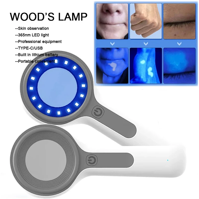 Woods Lamp For Skin Analyzer Machine Ultraviolet Lamp UV Skin Examination Beauty Test Facial Magnifying Analysis Vitiligo Lamp