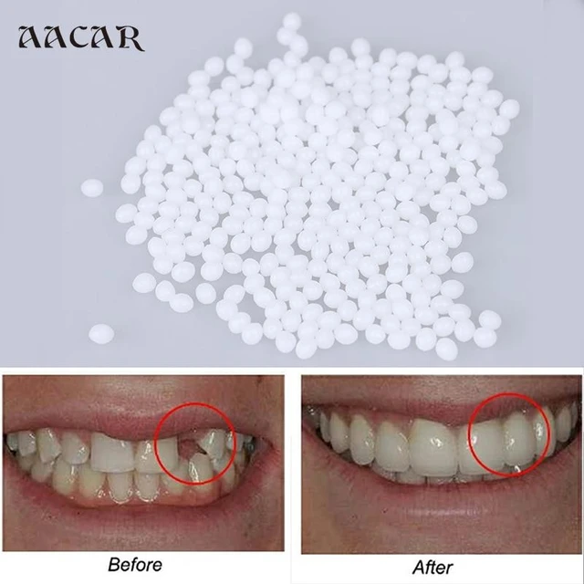10g Temporary Tooth Repair Kit White Fake Teeth Veneer Thermal Beads  Adhesive Beads - Denture Care Products - AliExpress