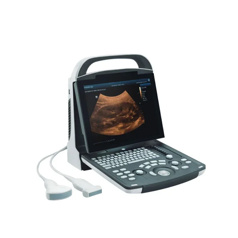 

All-digital portable ultrasound diagnostic system