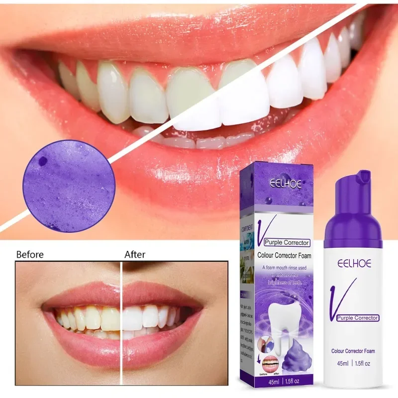 sdotter-dentifrice-violet-blanchissant-les-dents-v34-mousse-blanchissante-livres-oraux-soins-dentaires-reparation-du-wiltshire-jaune-acne-nouveau