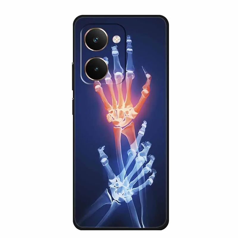 Premium Black TPU Silicone Soft Back Cover Case - Sleek & Durable Protection