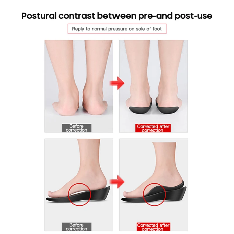 Orthopedic Insoles Orthotics Flat Foot Health Sole Pad For Shoes Insert Arch Support Pad For Feet Care Insoles Unisex 1 Pair