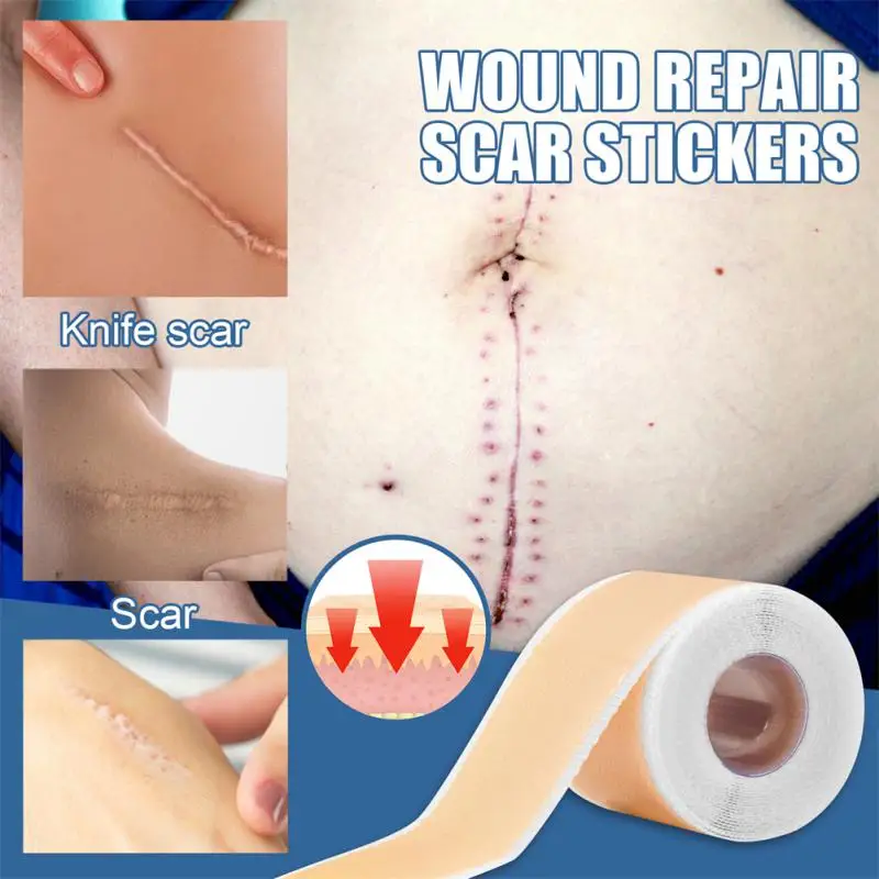 

Efficient Surgery Scar Removal Silicone Gel Tape Sticker Sheet Therapy Patch For Acne Trauma Burn Scar Skin Treatment Repair