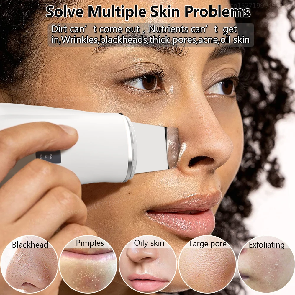 Ultrasonic Peeling Remover Blackhead Facial Skin Scrubber Facial Shovel Deep Cleaning Face Lifting Removal Pore Acne EMS Lift 2