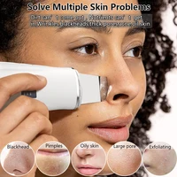 Ultrasonic Peeling Remover Blackhead Facial Skin Scrubber Facial Shovel Deep Cleaning Face Lifting Removal Pore Acne EMS Lift 2