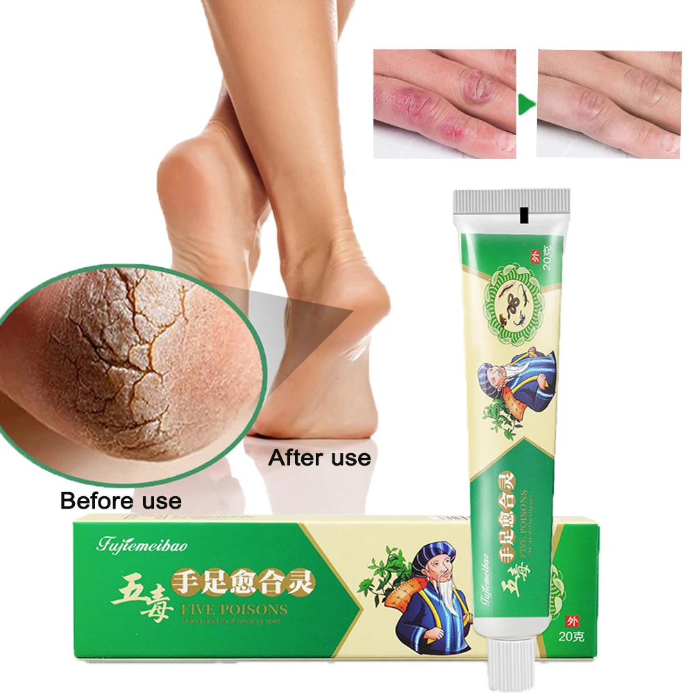 20g Anti Crack Cream  Protect Skin Prevent Frostbite Herbal Chaps Ointment Repair Cracked Heels Relieve Chilblains Moisturizing