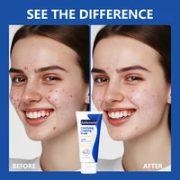 Acne Foaming Wash Benzoyl Peroxide 10% Maximum Antimicrobia Oil-Control Reduces Redness Deep Cleaning for Face & Body Skincare 2