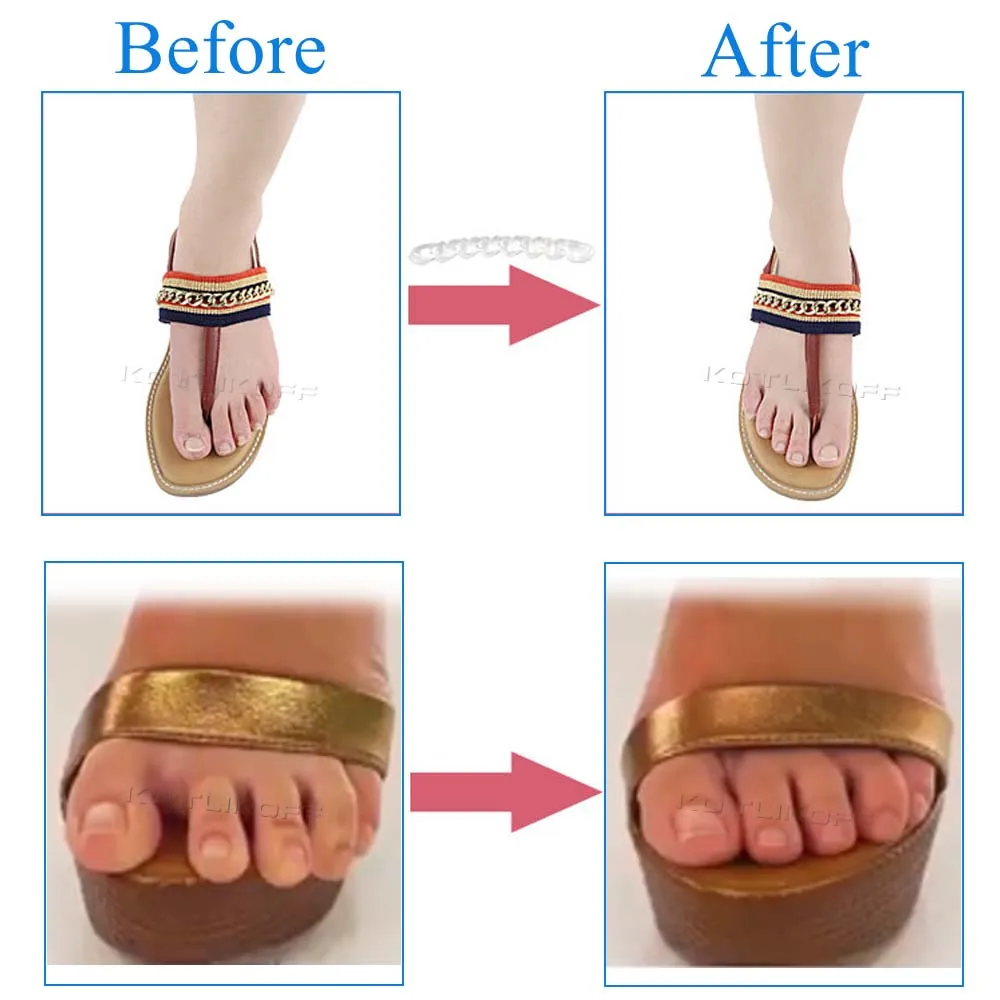 Women's Non-Slip Silicone Shoe Inserts - Self-Adhesive Gel Pads