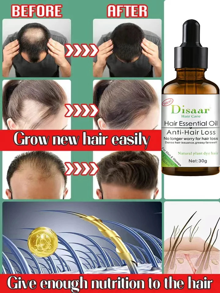 Buy Hair Follicle Repair Hair Growth Plant Essence Oil Rapid AntiHair Loss Regeneration Sssence