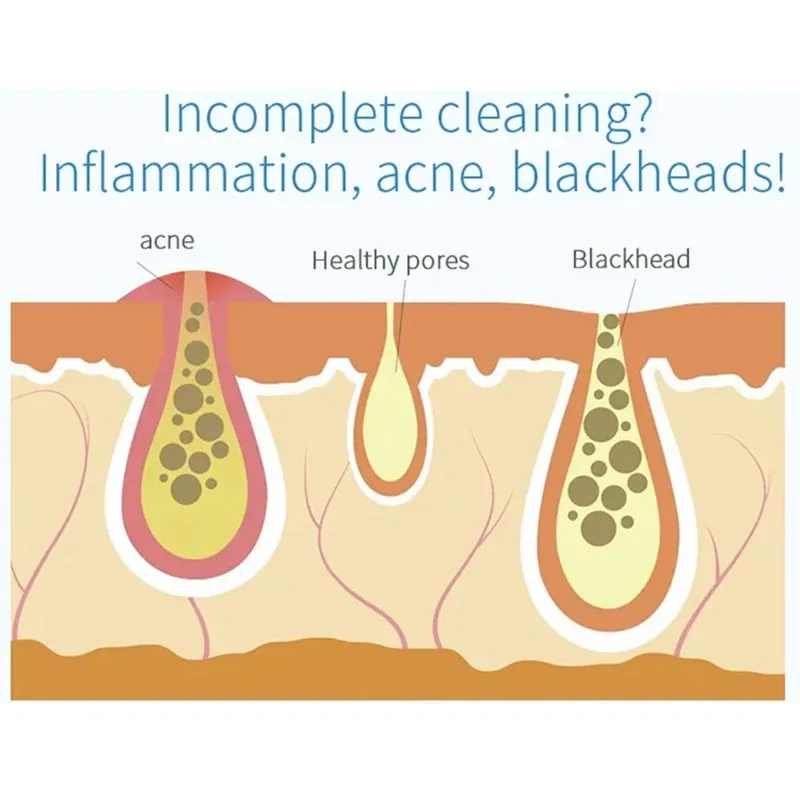 NEW Peeling Beauty Device New Small Bubble Oxygen Injection Instrument Hydra Dermabrasion Aqua Facial Cleaning Suction Blackhead