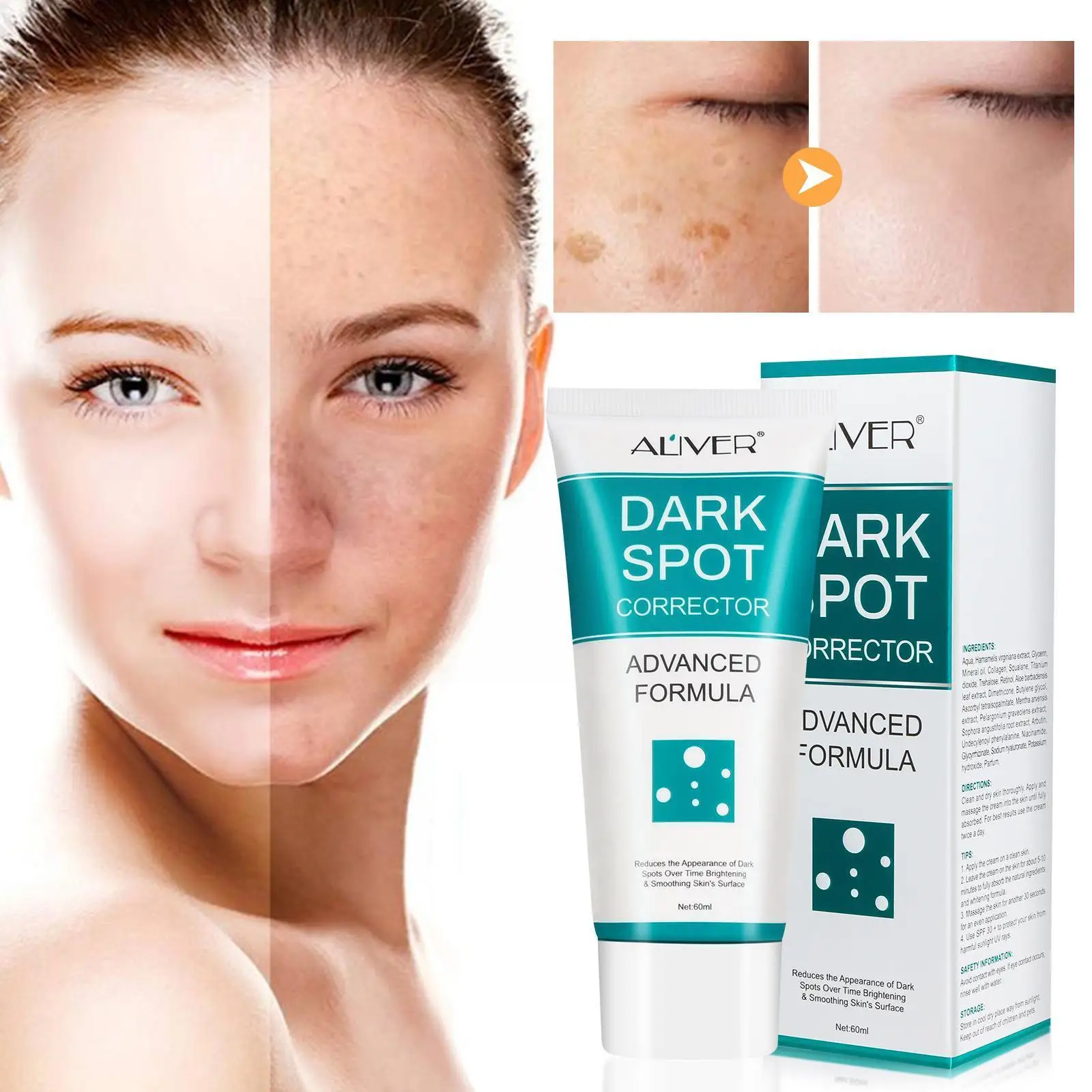 

60ml ALIVER Dark Spot Corrector Cream Whitening Freckle Care Spots Dark Skin Melasma Pigmentation Cream Remove Powerful T1V9