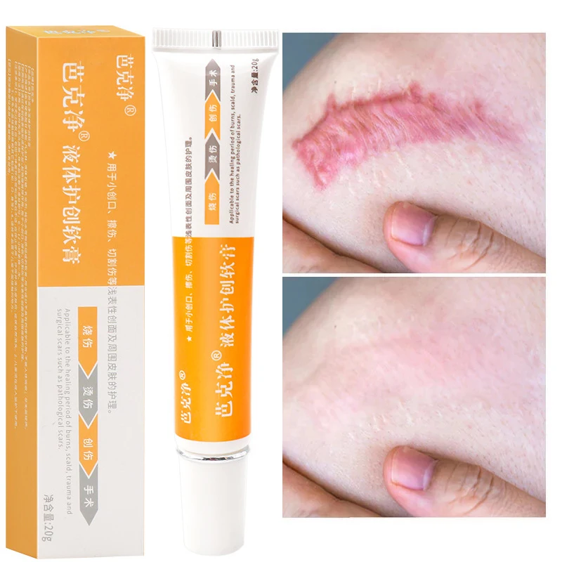 

Acne Scar Removal Face Cream Acne Spots Acne Pigmentation Corrector Anti Scar Stretch Marks Repair Skin Care