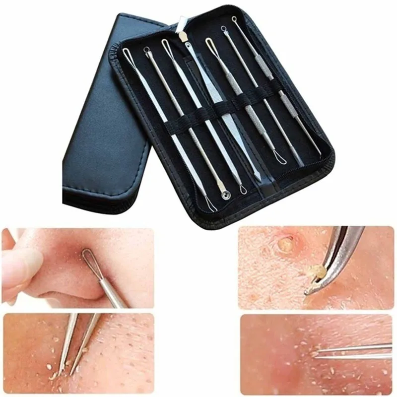 9pcs Stainless Acne Needle Blackhead and Pimple Remover Face Care Comedone Extractor Head Remover Tool Sets Point Clean Black