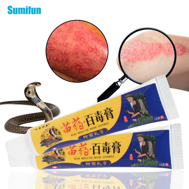 16g Antipruritic Cream Itching Hands Feet Itching Private Parts