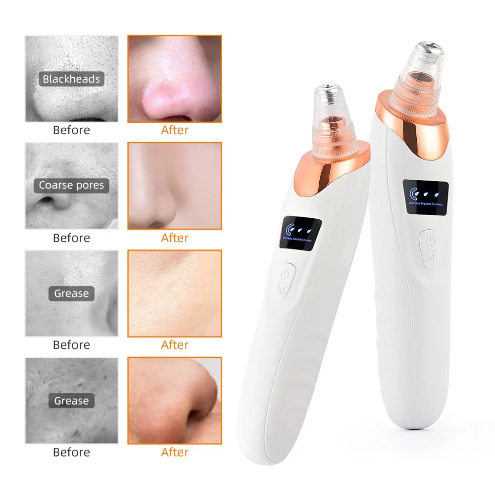 Nose Blackhead Remover Face Cleansing Beauty Machine Facial Suction Cleaner Pimple Dead Skin Remover Extractor Skin Care Tools