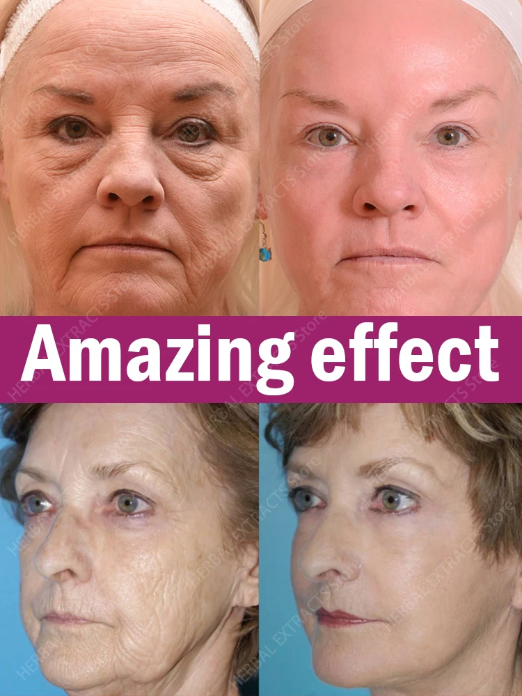 Anti Wrinkle Aging Instant Effect Remove Facial Wrinkles