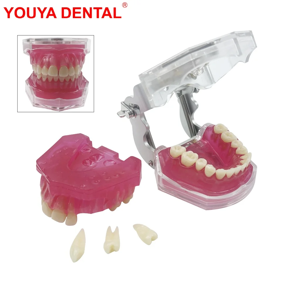 

Standard Dental Model With Removable Teeth Dentistry Jaw Teeth Model With Soft Gum Typodont For Studying Teaching Education Demo