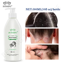 

Zudaifu Hair Psoriasis Seborrheic Skin Care Treatment Dermatitis Eczema Compound Herbal Shampoo Repair Scalp, Remove Dandruff