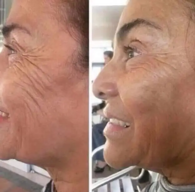 

Uplifting Cream, Wrinkle Cream, Antiaging, Moisturizer, Radiant Skin, Face Firming, Sagging Skin, Face Lift