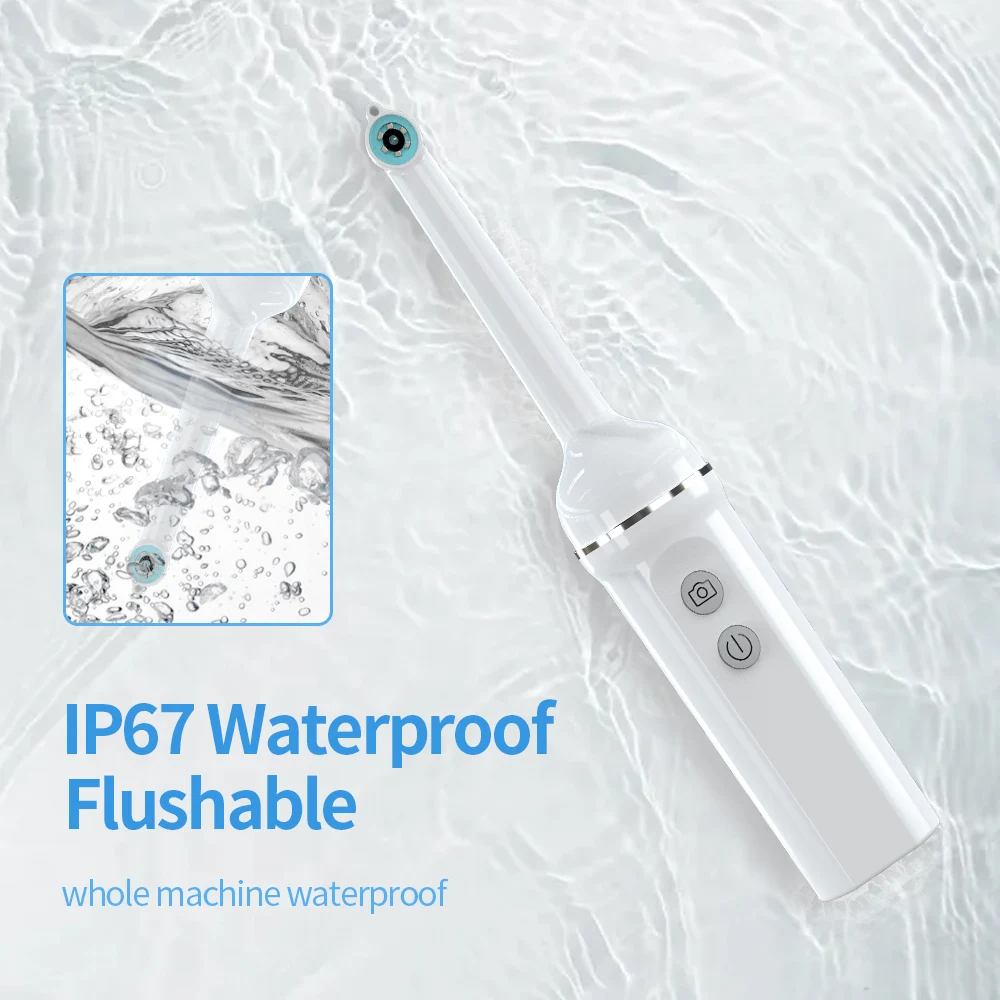 Wireless HD Intraoral Camera with LED Lighting
