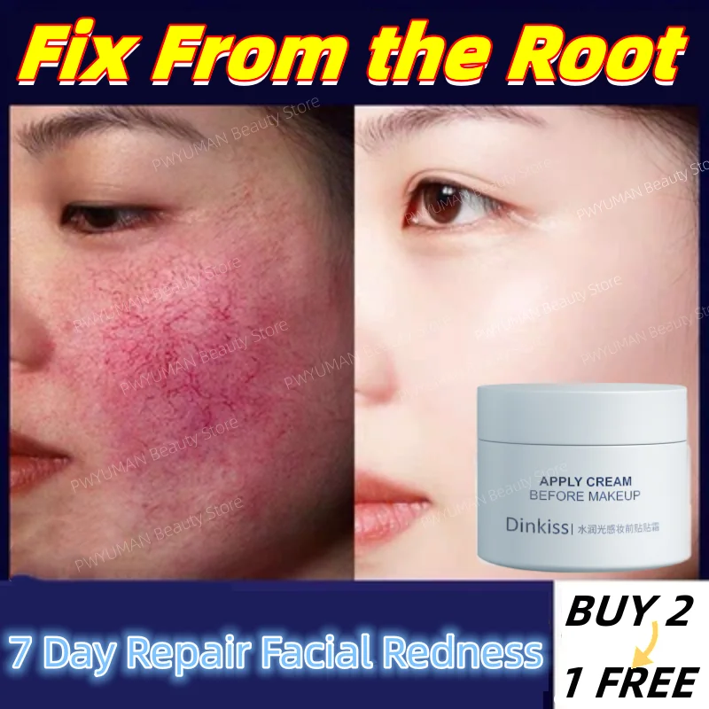Effective Facial Redness Repair Cream Rosacea Treat, 45 OFF