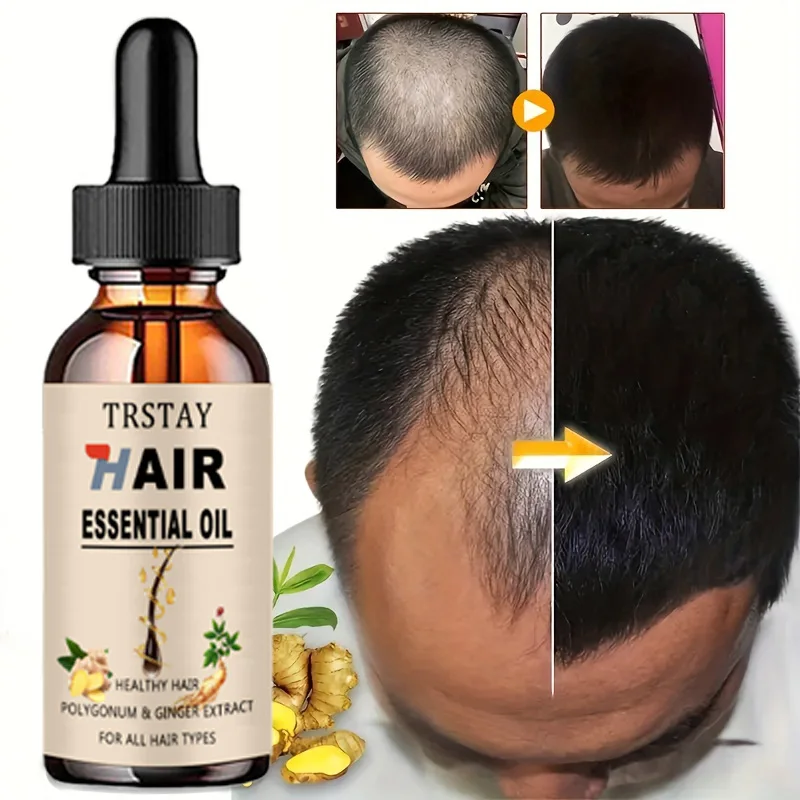 New 2022 Ginger Hair Growth Shampoo Hair Scalp Treatment Hair Growth Control Anti Dense Itching Oil Hair Care Hair Loss Anti