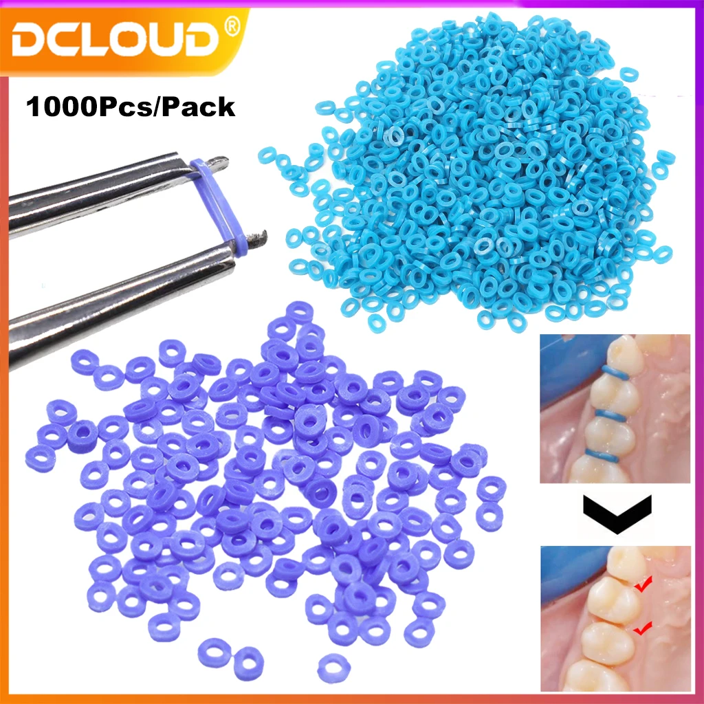 1000Pcs/Pack Separatore Dentale Ortodonzia Legature Separate Cravatte Elastiche Elastiche Continue Elastiche Anelli Di Gomma Dentista